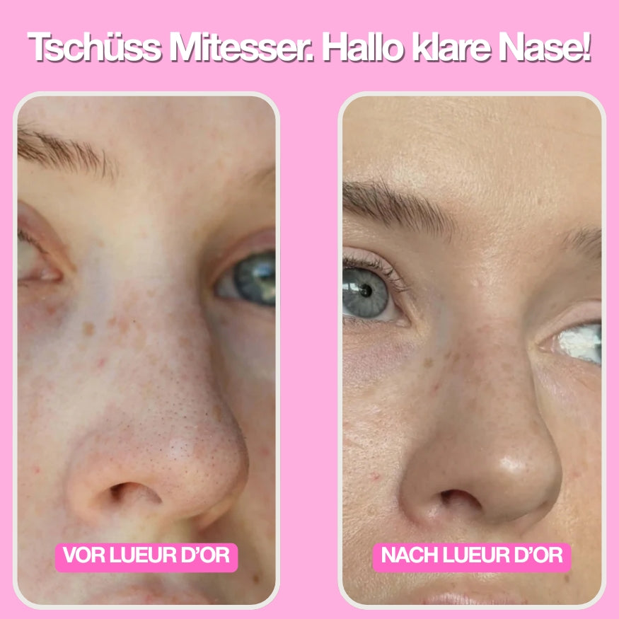 Nose Patches