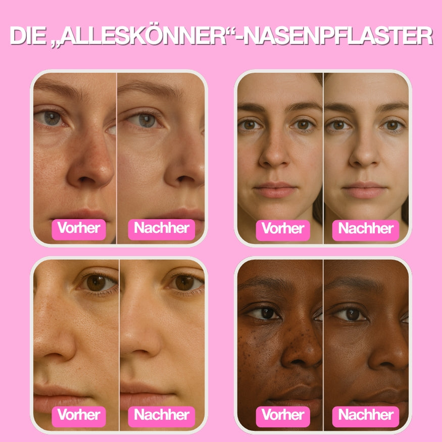 Nose Patches