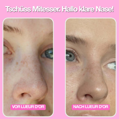 Nose Patches